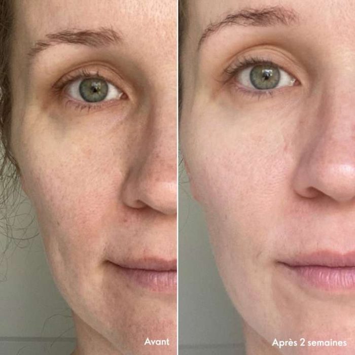 Routine Légère Novage+ Blemish + Age Defy